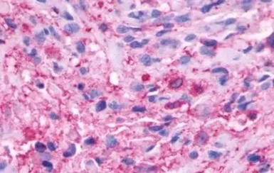 Anti-beta 3 Adrenergic Receptor antibody used in IHC (Paraffin sections) (IHC-P). GTX70685