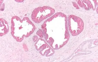 Anti-beta 3 Adrenergic Receptor antibody used in IHC (Paraffin sections) (IHC-P). GTX70685