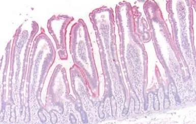 Anti-beta 3 Adrenergic Receptor antibody used in IHC (Paraffin sections) (IHC-P). GTX70685
