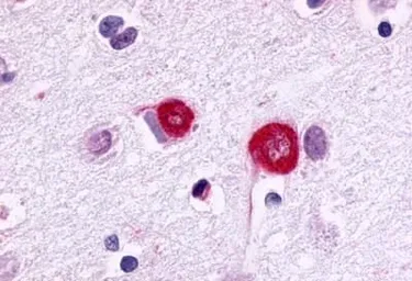 Anti-GPR17 antibody used in IHC (Paraffin sections) (IHC-P). GTX70687