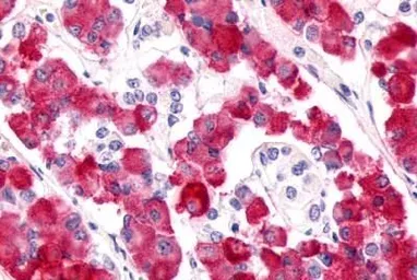 Anti-GPR17 antibody used in IHC (Paraffin sections) (IHC-P). GTX70687