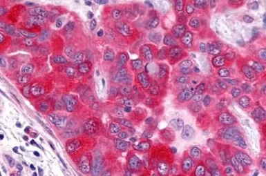 Anti-GPR17 antibody used in IHC (Paraffin sections) (IHC-P). GTX70687