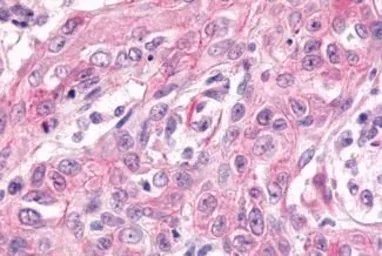 Anti-GPR17 antibody used in IHC (Paraffin sections) (IHC-P). GTX70687