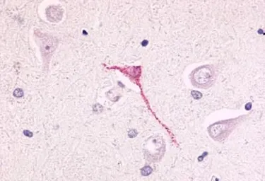 Anti-GPR17 antibody used in IHC (Paraffin sections) (IHC-P). GTX70687
