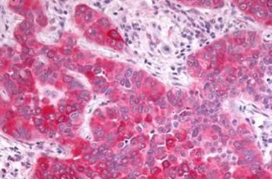 Anti-GPR17 antibody used in IHC (Paraffin sections) (IHC-P). GTX70687