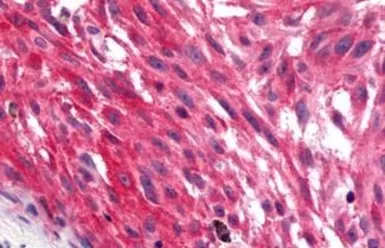 Anti-GPR17 antibody used in IHC (Paraffin sections) (IHC-P). GTX70687