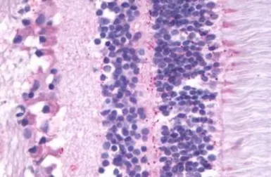 Anti-MT2 antibody used in IHC (Paraffin sections) (IHC-P). GTX70721