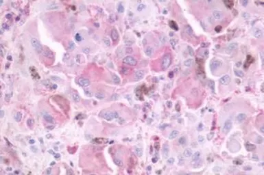 Anti-MT2 antibody used in IHC (Paraffin sections) (IHC-P). GTX70721