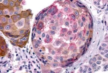 Anti-MT2 antibody used in IHC (Paraffin sections) (IHC-P). GTX70723