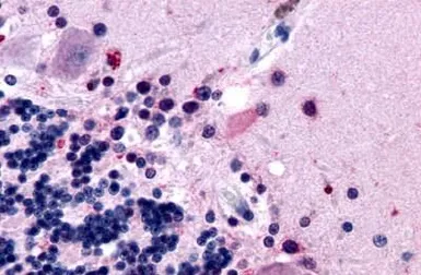 Anti-MT2 antibody used in IHC (Paraffin sections) (IHC-P). GTX70723