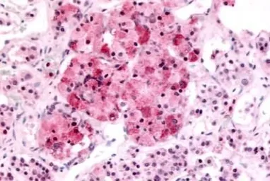 Anti-MT2 antibody used in IHC (Paraffin sections) (IHC-P). GTX70723
