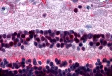 Anti-MT2 antibody used in IHC (Paraffin sections) (IHC-P). GTX70723