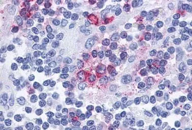 Anti-CCR10 antibody used in IHC (Paraffin sections) (IHC-P). GTX70743