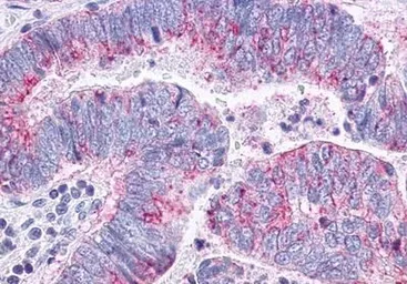 Anti-CCR10 antibody used in IHC (Paraffin sections) (IHC-P). GTX70743