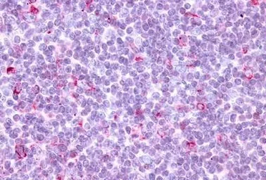 Anti-CCR10 antibody used in IHC (Paraffin sections) (IHC-P). GTX70743