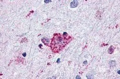 Anti-Glucagon like peptide 2 receptor antibody used in IHC (Paraffin sections) (IHC-P). GTX70765