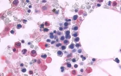 Anti-CD97 antibody used in IHC (Paraffin sections) (IHC-P). GTX70829