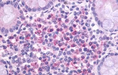 Anti-CD97 antibody used in IHC (Paraffin sections) (IHC-P). GTX70829