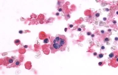 Anti-CD97 antibody used in IHC (Paraffin sections) (IHC-P). GTX70829