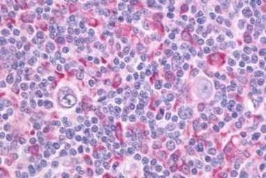 Anti-CD97 antibody used in IHC (Paraffin sections) (IHC-P). GTX70829