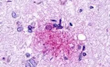 Anti-GPR84 antibody used in IHC (Paraffin sections) (IHC-P). GTX70843