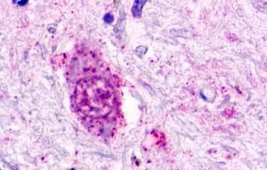 Anti-GPR84 antibody used in IHC (Paraffin sections) (IHC-P). GTX70843
