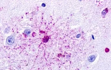 Anti-GPR84 antibody used in IHC (Paraffin sections) (IHC-P). GTX70843
