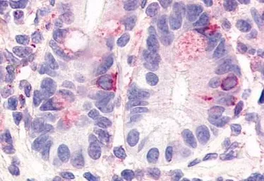 Anti-HNF4 gamma antibody used in IHC (Paraffin sections) (IHC-P). GTX70879