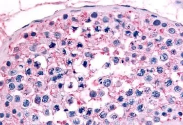 Anti-GCNF antibody used in IHC (Paraffin sections) (IHC-P). GTX70915