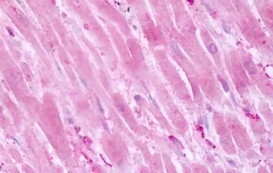 Anti-PTPRA antibody used in IHC (Paraffin sections) (IHC-P). GTX70943