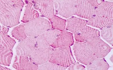Anti-PTPRA antibody used in IHC (Paraffin sections) (IHC-P). GTX70943