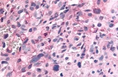 Anti-PTPRE antibody used in IHC (Paraffin sections) (IHC-P). GTX70949