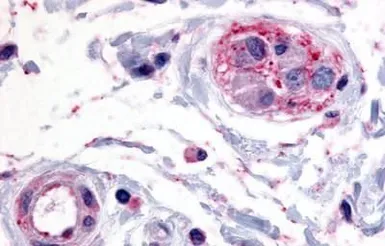 Anti-PTPRE antibody used in IHC (Paraffin sections) (IHC-P). GTX70949