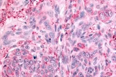 Anti-PTPRE antibody used in IHC (Paraffin sections) (IHC-P). GTX70951