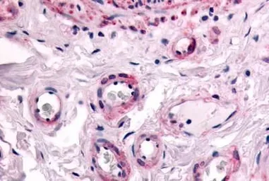 Anti-PTPRE antibody used in IHC (Paraffin sections) (IHC-P). GTX70951