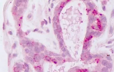 Anti-HUNK antibody used in IHC (Paraffin sections) (IHC-P). GTX70961