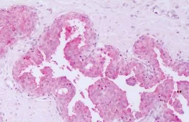 Anti-HUNK antibody used in IHC (Paraffin sections) (IHC-P). GTX70961