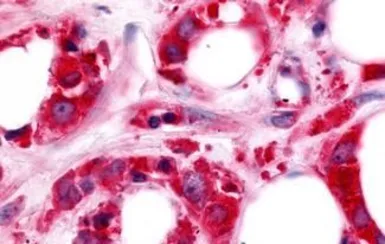 Anti-HUNK antibody used in IHC (Paraffin sections) (IHC-P). GTX70967