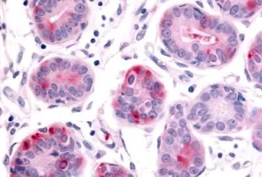 Anti-HUNK antibody used in IHC (Paraffin sections) (IHC-P). GTX70967