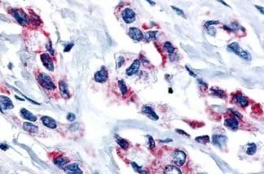 Anti-ERR beta antibody used in IHC (Paraffin sections) (IHC-P). GTX70969