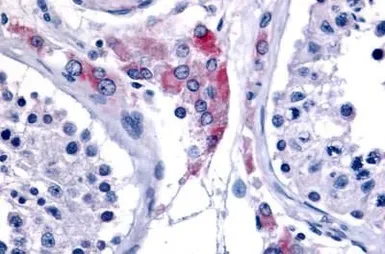 Anti-ERR beta antibody used in IHC (Paraffin sections) (IHC-P). GTX70969