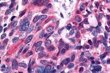 Anti-ERR beta antibody used in IHC (Paraffin sections) (IHC-P). GTX70971