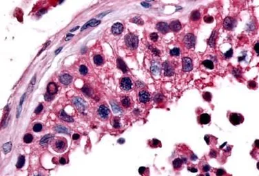 Anti-ERR beta antibody used in IHC (Paraffin sections) (IHC-P). GTX70971