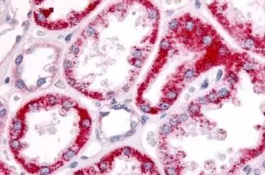 Anti-SGK2 antibody used in IHC (Paraffin sections) (IHC-P). GTX70977