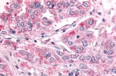 Anti-SGK2 antibody used in IHC (Paraffin sections) (IHC-P). GTX70977