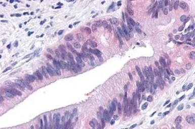 Anti-TNIK antibody used in IHC (Paraffin sections) (IHC-P). GTX70985