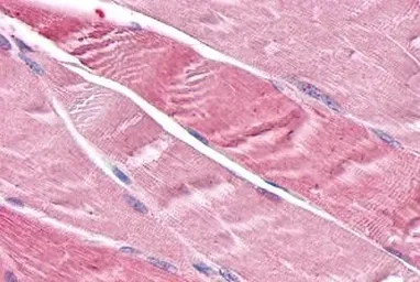 Anti-TNIK antibody used in IHC (Paraffin sections) (IHC-P). GTX70985