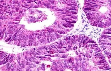 Anti-GPR12 antibody used in IHC (Paraffin sections) (IHC-P). GTX70989