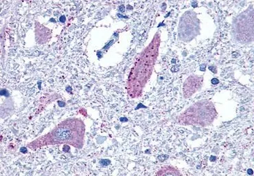 Anti-mGluR8 antibody used in IHC (Paraffin sections) (IHC-P). GTX71001