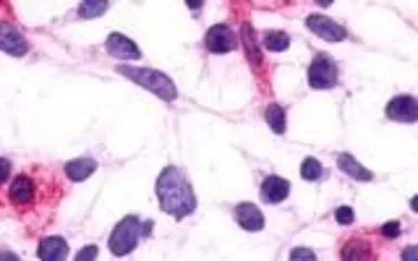 Anti-PTGFR antibody used in Immunocytochemistry/ Immunofluorescence (ICC/IF). GTX71101